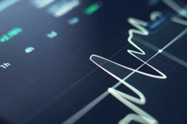 媒体：美国政府准备针对巴西采取新措施